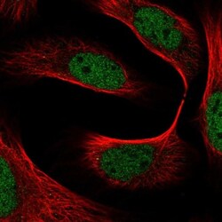 BOD1L Antibody, Novus Biologicals 25 &mu;L, Unlabeled:Antibodies, Polyclonal